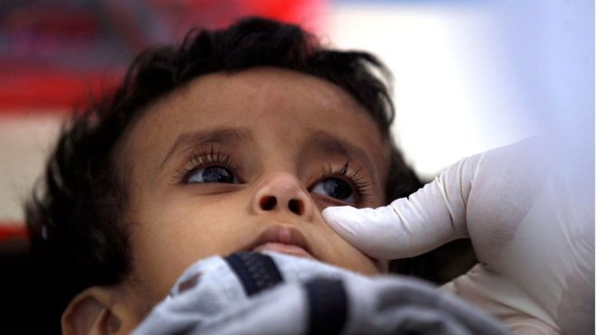"الكوليرا".. وباء حبس أنفاس اليمنيين لشهرين في طريقه للانحسار 