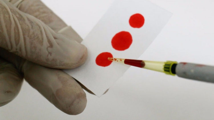 تحليل الدم بالهاتف الجوال.. ابتكار باحثين أتراك 